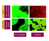 Bacteria and Chronic Infections -  Chronic Infections - Treatment Failure (20:23)